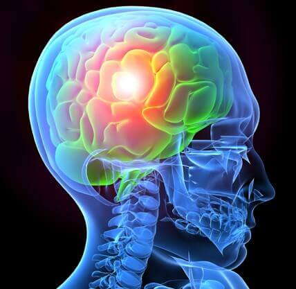 brain injury CGI