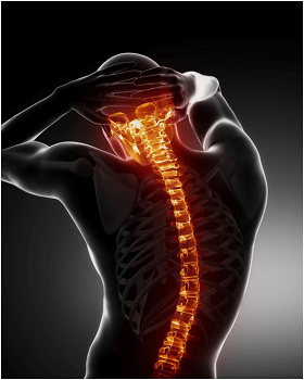 symptoms of whiplash