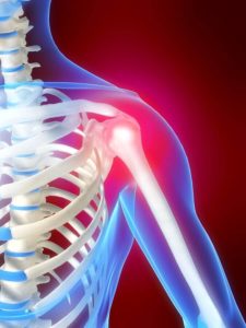 car accident shoulder pain