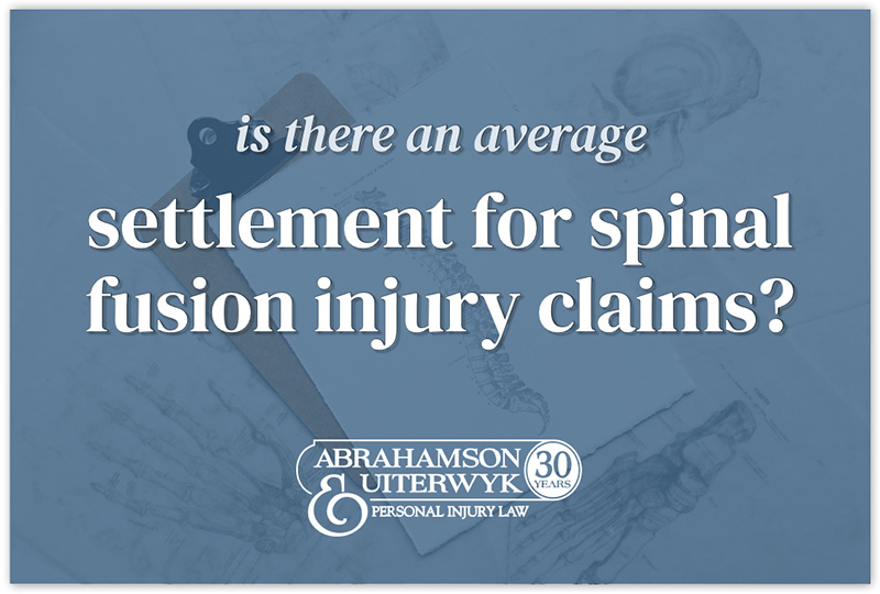 average settlement for spinal fusion lawsuit