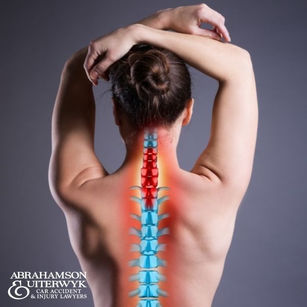 back injury lawyers florida a&u (1) spinal injury