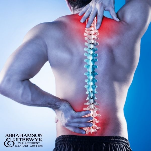 back-injury-lawyers-florida-au-