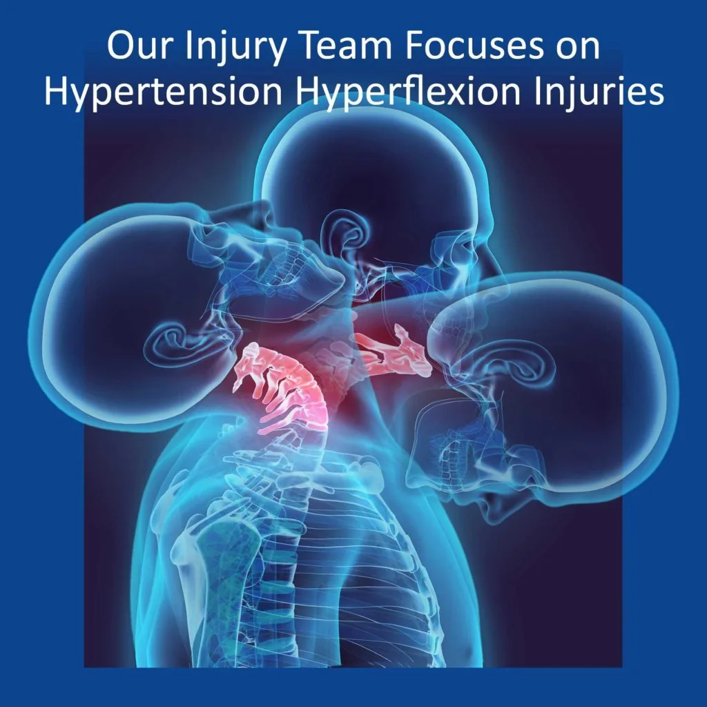 personal-injury-lawyer-in-port-charlotte-car-accident-lawyer-near-you