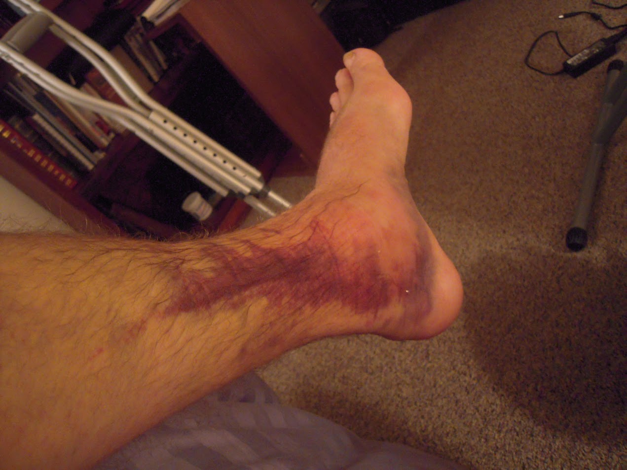 florida pedestrian accident injury lawyer
